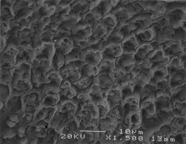 SEM photograph of SEP enamel surface (1500 times magnification). Figure 10 shows a representative enamel appearance after 37% phosphoric acid treatment and application of a cured sealant layer.