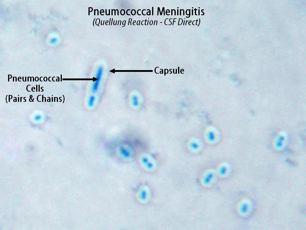 Quellung Reaction When pneumococci of a certain type are mixed with specific