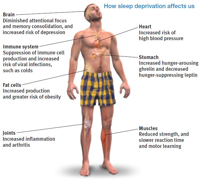 Module 24- Sleep Deprivation, Sleep Disorders and Dreams Sleep Deprivation Effects of Lost Sleep - feeling tired on all levels (physical, mental, emotional) - can be a predictor of