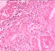 HISTOPATHOLOGY AND REPORT WITH