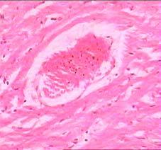 II: The histology of Heart from the