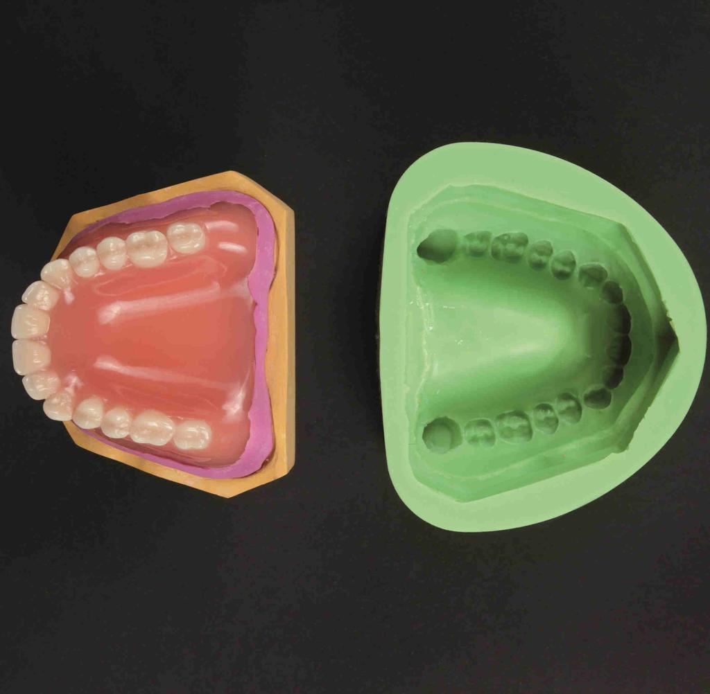 Use a duplication form to duplicate the full denture with the model.