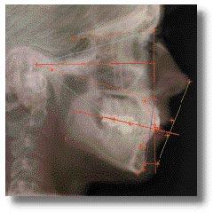 P R A C T I C E E N H A N C E M E N T Orthodontic Digital Imaging... 176-177 Videos.