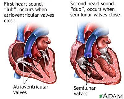 4. The phonocardiogram is recorded using microphones placed on the thorax in the main auscultatory areas; these microphones filtrate the sounds in between 25 and 200 Hz.