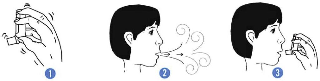 VII. USING YOUR BREATHING AIDS A. Metered-Dose Inhaler An inhaler is a sprayer made to deliver a dose of medicine that you can breathe deeply into your lungs.