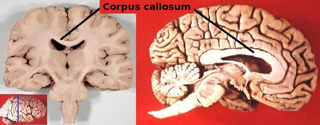 Cerebral Cortex Principles CORPUS CALLOSUM Largest white matter structure in the brain.