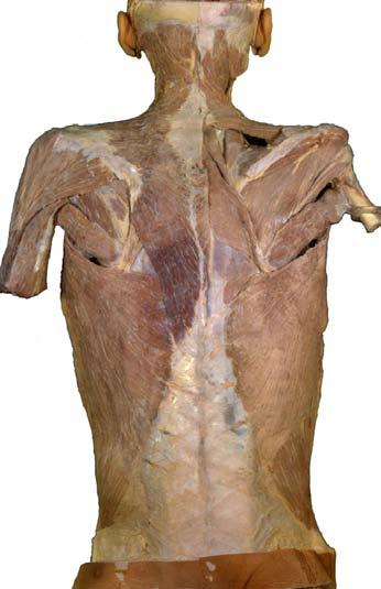 Activity Seven Muscles: a) Label the superficial muscles of the back on
