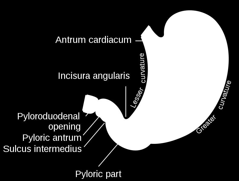 part of the lesser curvature ) 3- Pyloric region divided into: a-