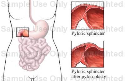 Pyloric opening cont -The pyloric sphincter controls the outflow of gastric contents into the duodenum.