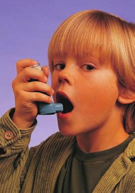 Medication Therapy Steroid Burst Many children with asthma periodically require a shortterm burst of steroid pills or syrups to decrease the severity of asthma symptoms and prevent an emergency room