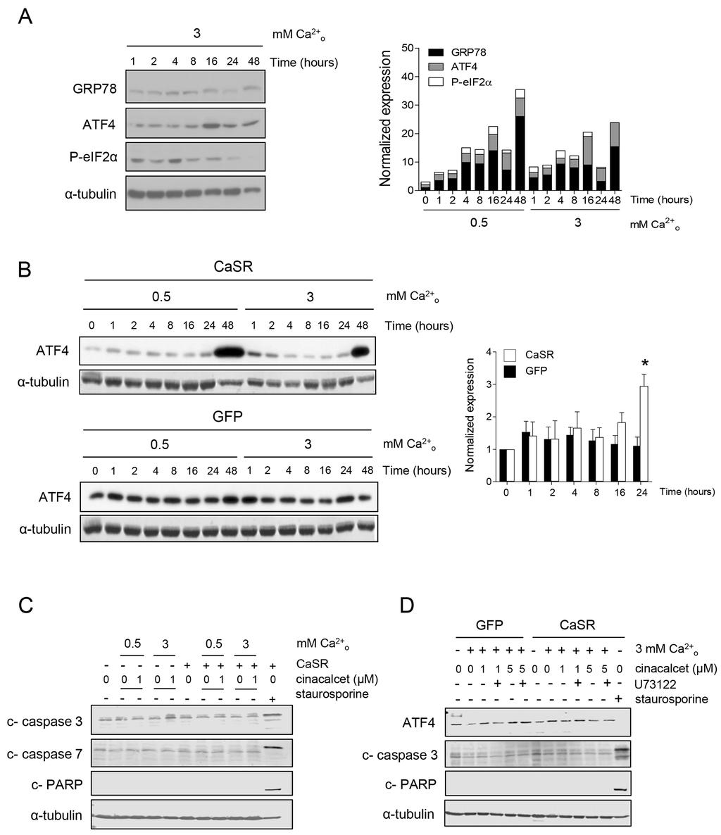 Supplementary Figure S2: Cinacalcet induces ER stress in CaSR-positive, MYCN-amplified neuroblastoma cell lines. A.