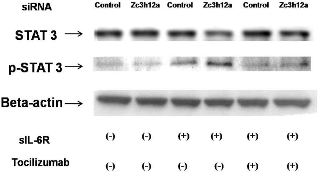 Fig. 4. The effect of Zc3h12a knockdown on cytokines or LPS induced IL-6 mrna expression. FLS were treated with control sirna or Zc3h12a sirna for 72 hours.