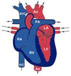 Ventricular systole causes ventricles to contract, RV forces high pressure blood through a semilunar valve into