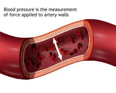 against arterial walls Major determinant is