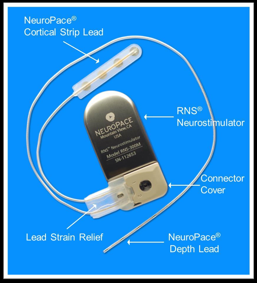 RNS (Neuropace) First of a kind device to provide targeted responsive stimulation for epilepsy Acute and sustained efficacy in