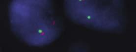 Fluorescence In Situ Hybridization RT PCR Fluorescence In