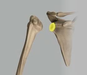 5) SHOULDER INSTABILITY Unit 1: Normal Shoulder Anatomy Clavicle (Fig. 4) Coracoid Process (Fig.