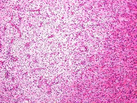 nuclei and pale eosinophilic