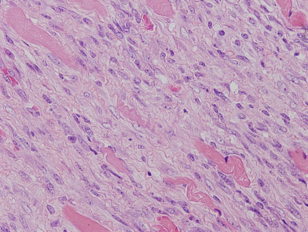 eosinophilic cytoplasms, nuclei with