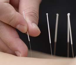 Acupuncture (not