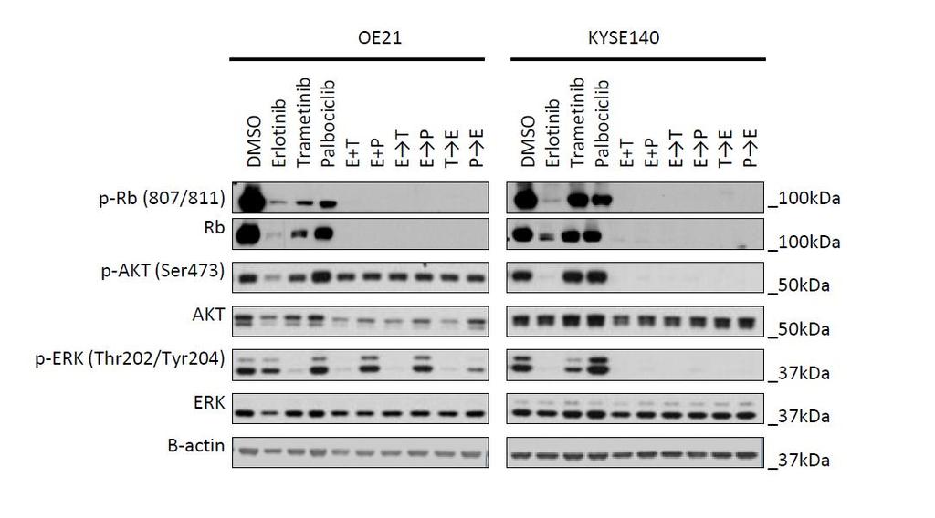Supplementary Figure 11. The MEK inhibitor trametinib reverses intrinsic resistance to EGFR inhibition in Ras-mutation KYSE30 cell line, but not TE8 and KYSE520 lines.