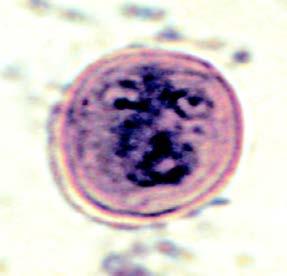 Protozoa: Giardia
