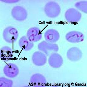 Protozoa: Plasmodium:-