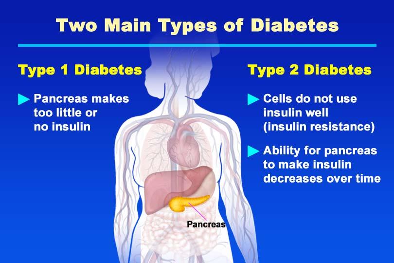 Two Main Types of Diabetes What is type 1 diabetes? Auto-immune destruction of insulin-producing cells of pancreas.
