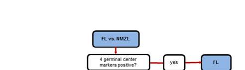 Nodal MZL with Follicular Colonization versus FL vs Nodal MZL Feature Nodal MZL Distribution of Confined to lymph node Extend into perinodal fat follicles Growth pattern Tumor begins outside follicle