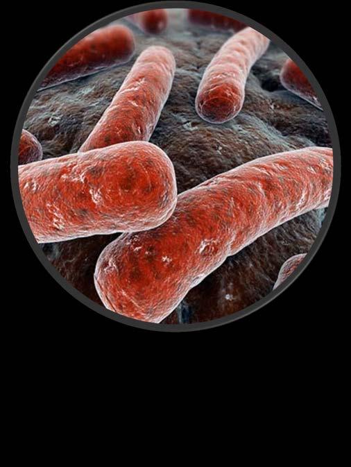 What is tuberculosis (TB)?