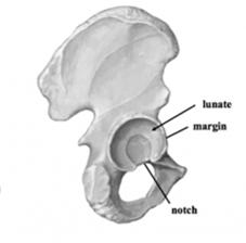 ischium and pubis) Proximal femoral