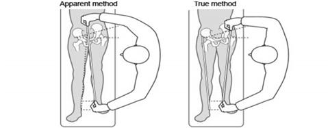 EXAM Exam begins with stance & gait evaluation Range of motion (ROM) compared side-to-side Muscle strength testing