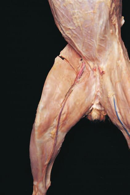 artery Femoral vein Adductors Sartorius