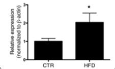 Inflammatory Mediator TLR-4 MCP-1 IL-1 Endocrinology.