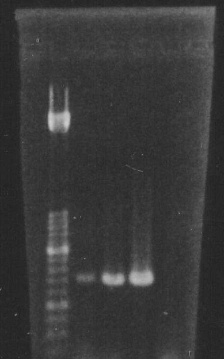 Gel picture showing amplified CHIK RNA 1 2 3 4 5 500 250 Lane 1 Lanes 2, 3 Lane 4