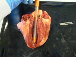 Figure 5: Opening the left ventricle 8. Longitudinal slice down the pulmonary artery (i.e. opening the right ventricle).