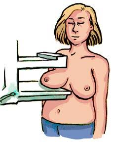 uk/screening/breast What does a breast x-ray feel like?