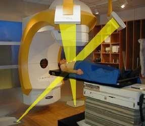 How is radiotherapy given? Before treatment: CT and simulation.