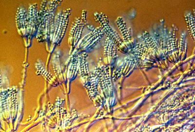 sac ( naked spores) Conidiospores