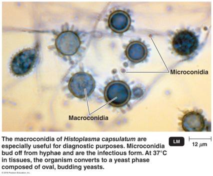 Histoplasma capsulatum Etiological agent of histoplasmosis Humans