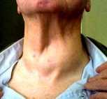 Outline Thyroid basics Thyroid exam Approach to