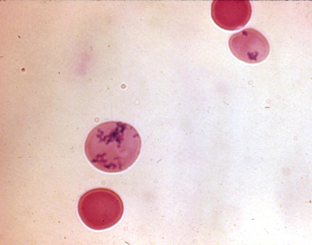 Reticulocytes Red cells