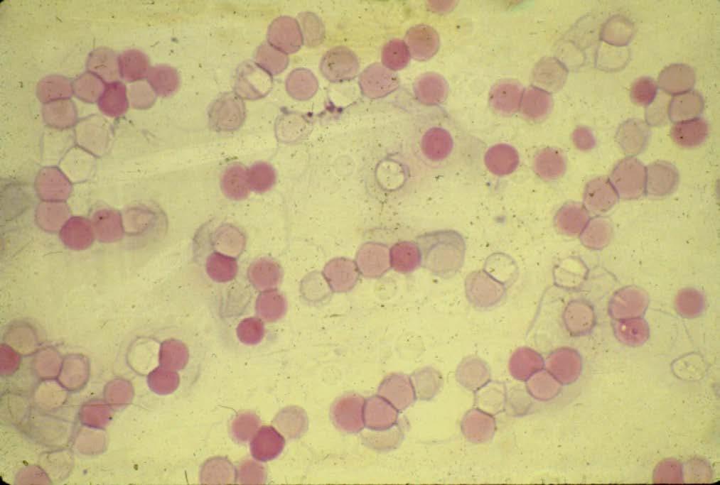 Fetal Hemoglobin