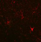 NTRX-07 Treats neuroinflammation NORMAL MICROGLIA Neuroinflammation ACTIVATED MICROGLIA CB2 agonist (NTRX-07)