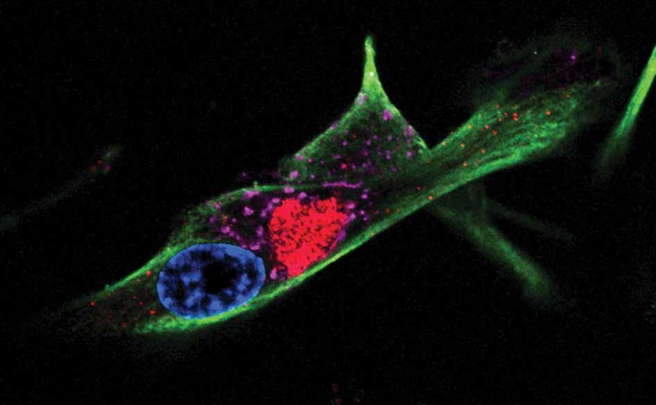 Confocal image of the TOR-autophagy spatial coupling compartment (TASCC) in Ras-induced senescent IMR90 cells.