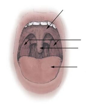 Soft palate Tonsils Uvula Tongue The red arrows show the muscle direction in a cleft palate (front to back) Why is surgery needed?