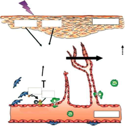 UVB irradiation VEGF-A TSP-1 Keratinocytes Skin damage Angiogenesis Vascular dilation Vascular leakage Inflammation-induced Matrix degradation Pericyte detachment Ang1 Tie2 Immune cells Endothelial