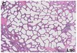 estrogen responsiveness of parous gland Diminution in number of mammary stem cells Britt et al.