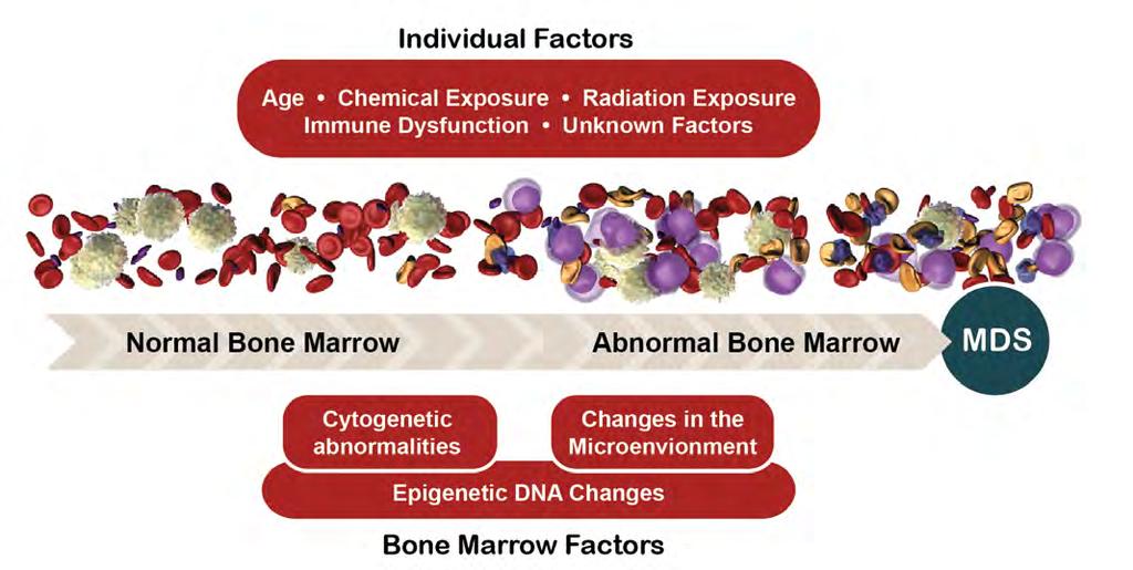 What Happens to Bone Marrow in MDS? Epigenetic changes Genes serve as blueprints for proteins. Proteins are the primary component of all living cells.