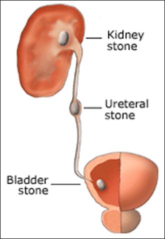 The ureters carry the urine from kidneys to the urinary bladder. Urinary bladder is a sac like structure which temporarily stores the urine.